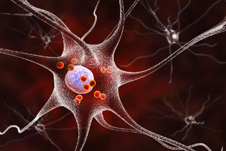 Deep Brain Therapy for Parkinson’s: Hope & Healing