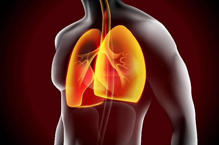 Minimally Invasive COPD Treatment for Easier Breathing