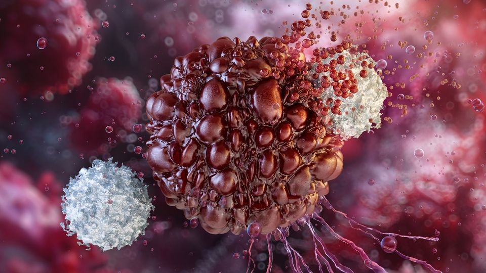 High-Risk Neuroblastoma Care: A Complete Family Guide