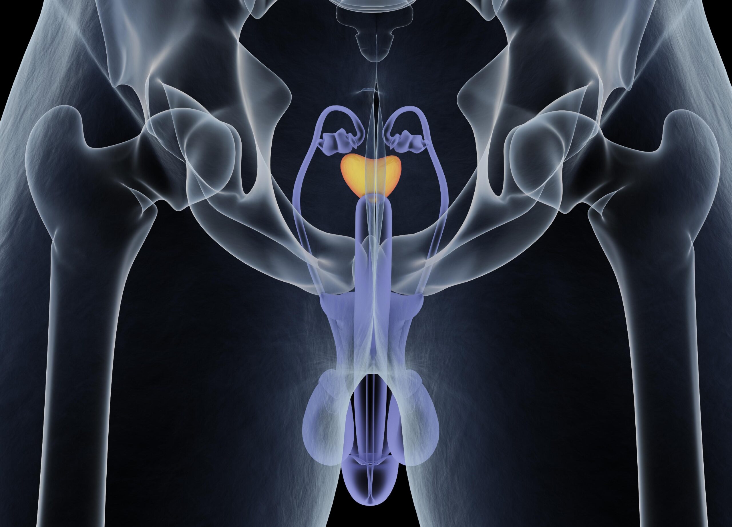Why Modern Oncology Relies on a PSMA Scan for Target Detection