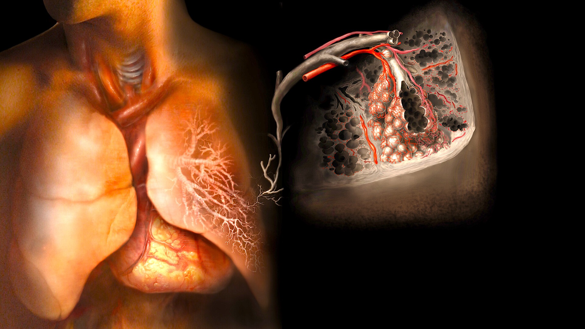 What Should You Know About Alpha-1 Antitrypsin Deficiency?